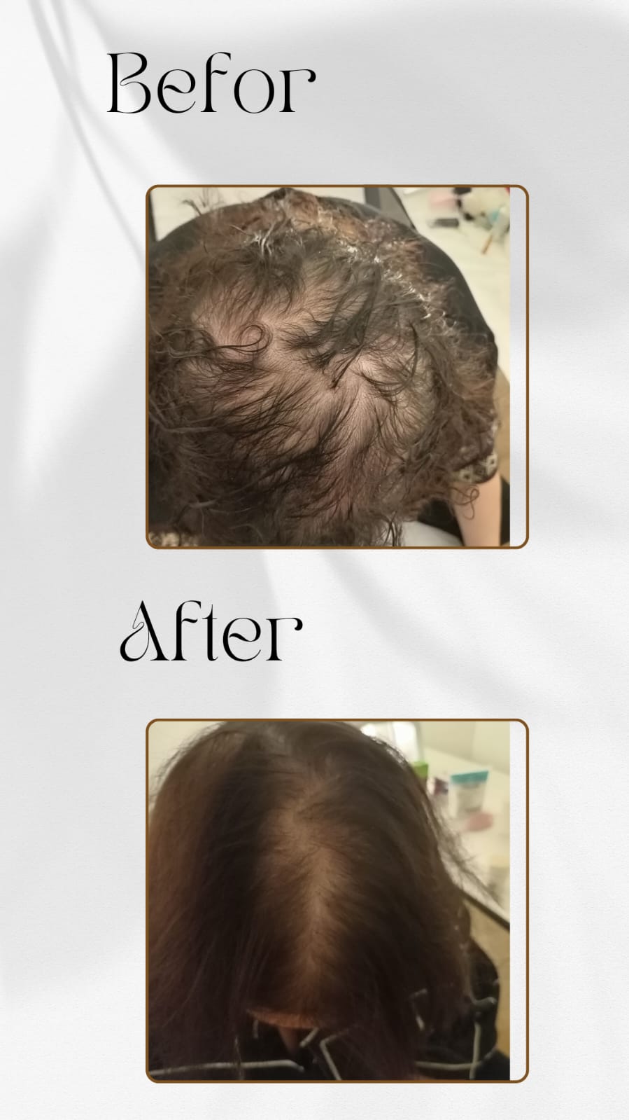 Soins Hairneeling women
