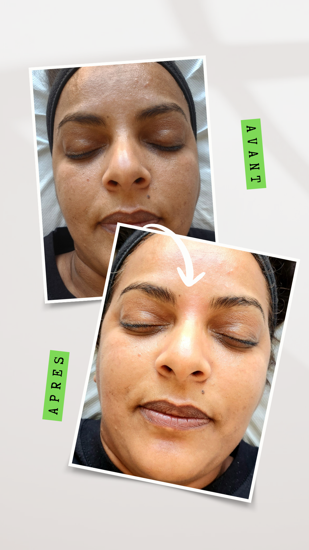 soin hydraskin 