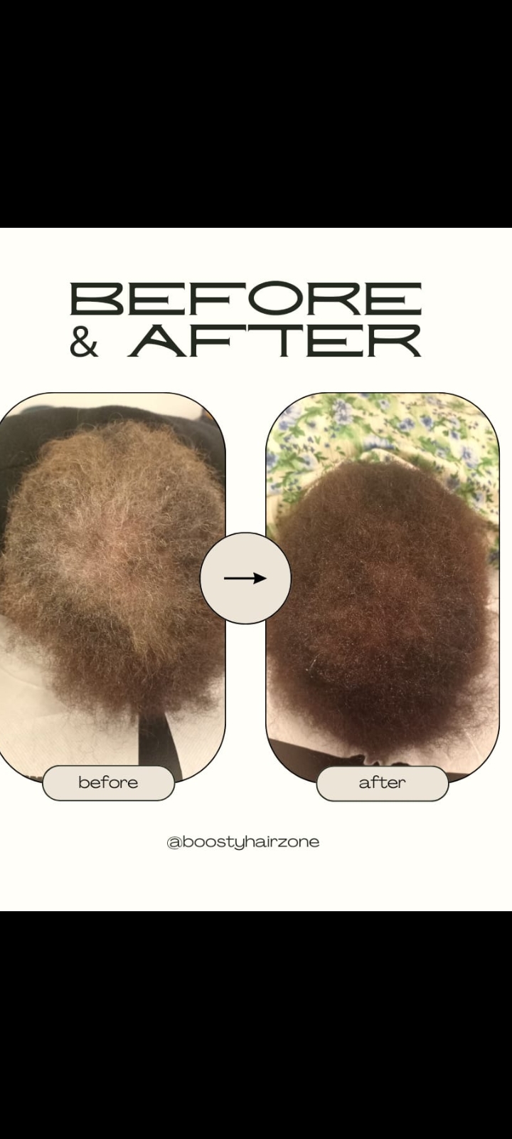 Befor and after 