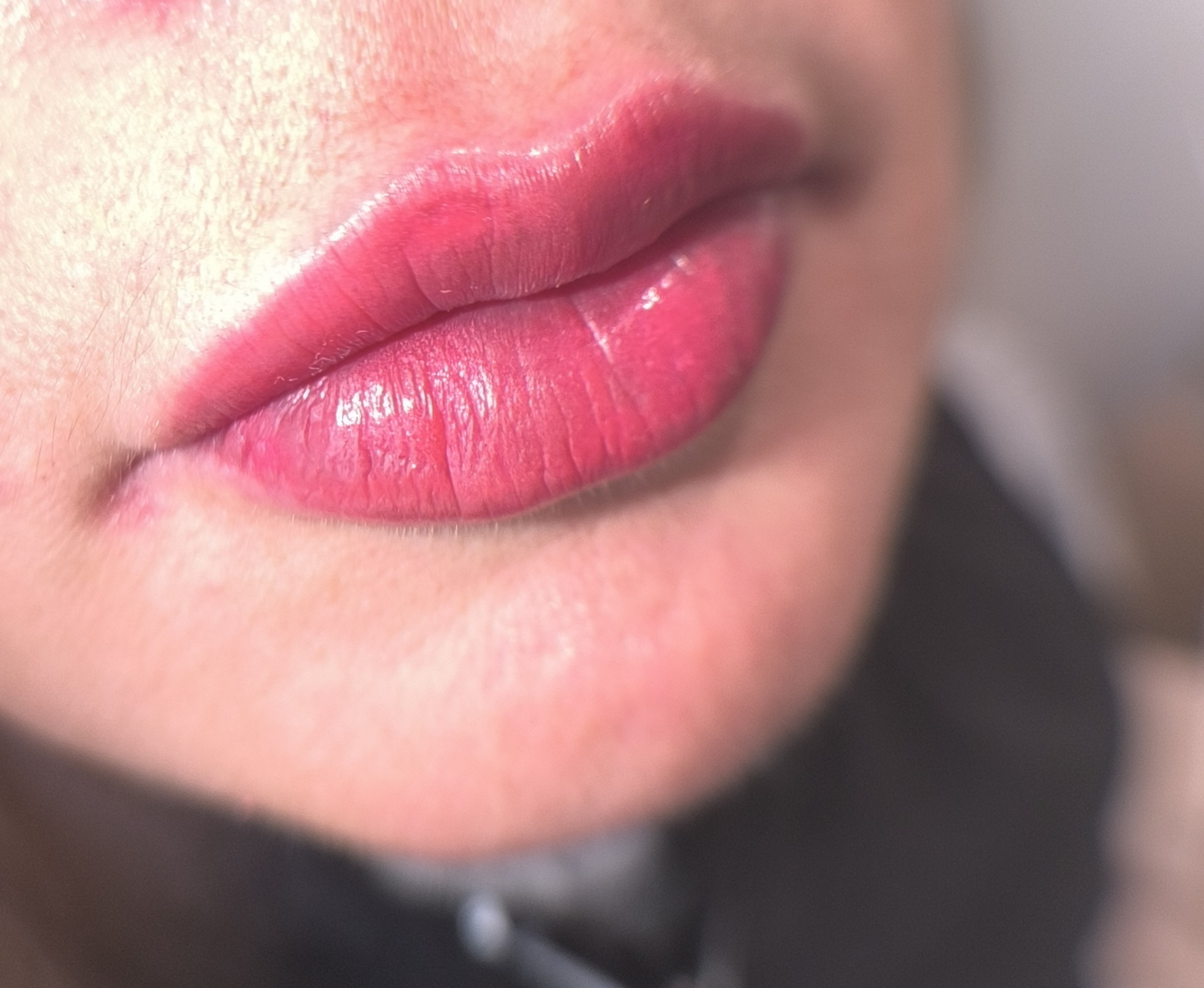 candy lips/ full lips
effet rouge a lèvres tout en délicatesse.
le pigment s'estompe de 50% environ après la cicatrisation