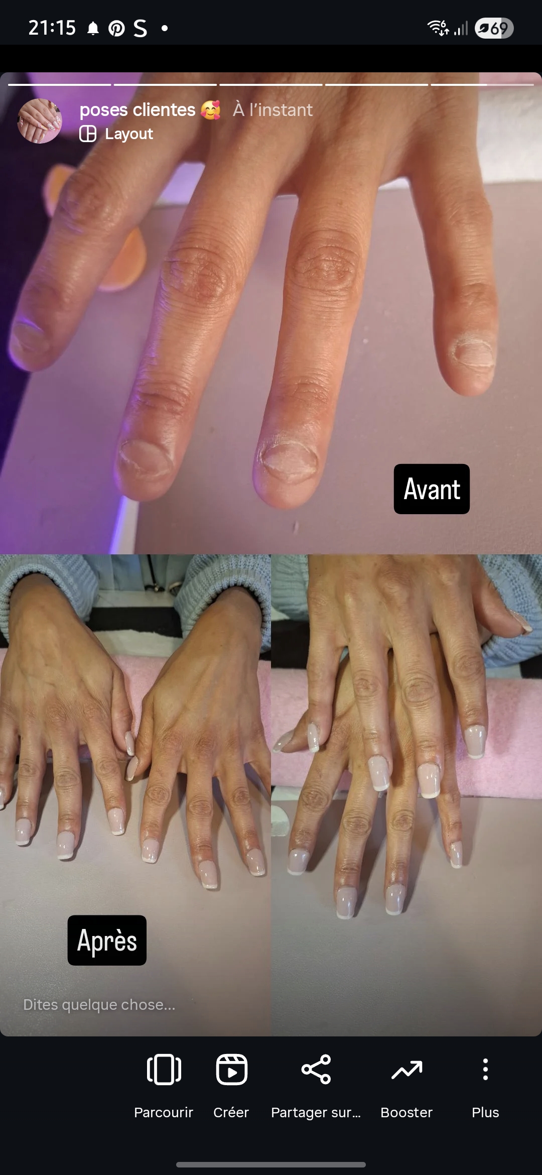 Sur ongles super ronger, construction de l’ongle au gel + pose américaine dessus
#débutante
