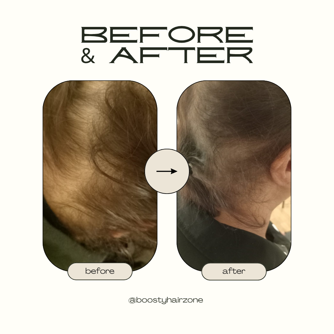Befor and after soins Hairneeling 